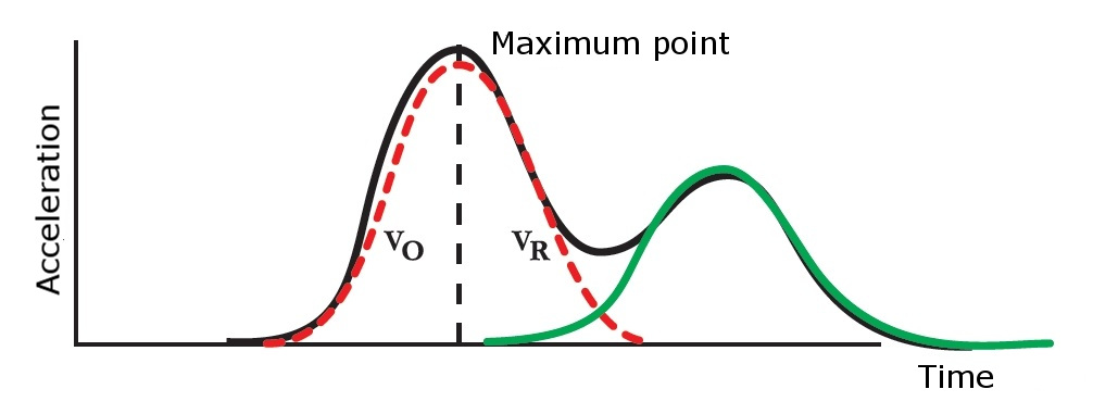 Waveform of loose anchor bolt
